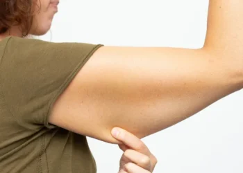 Mulher apontando para a flacidez do braço, ilustrando a necessidade de fortalecimento muscular.