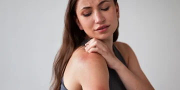 Mulher com erupção cutânea nas costas, aparentando desconforto, relacionada a transtornos emocionais.