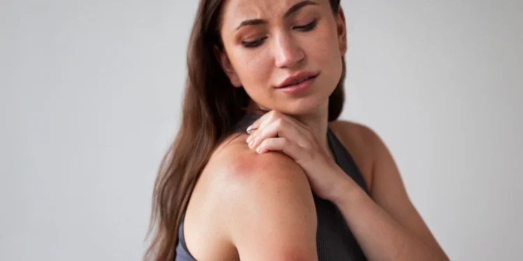 Mulher com erupção cutânea nas costas, aparentando desconforto, relacionada a transtornos emocionais.